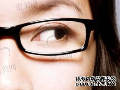 近视眼可以做双眼皮手术吗