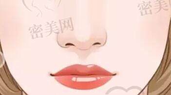 隆鼻动漫15.jpg?x-oss-process=style/cnzxzj