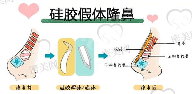 手术者
