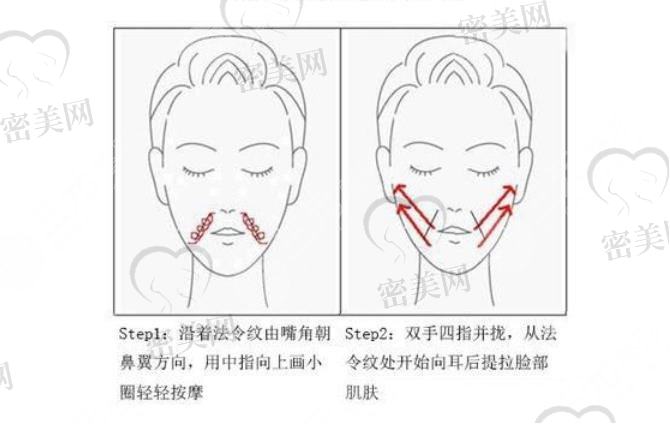 法令纹深用什么方法解决？填充和手术怎么选？抗衰除皱术前攻略~