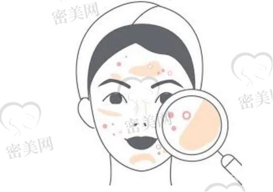 北京丽都医疗美容医院价格表，附激光祛痘案例
