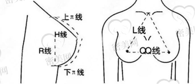 隆胸