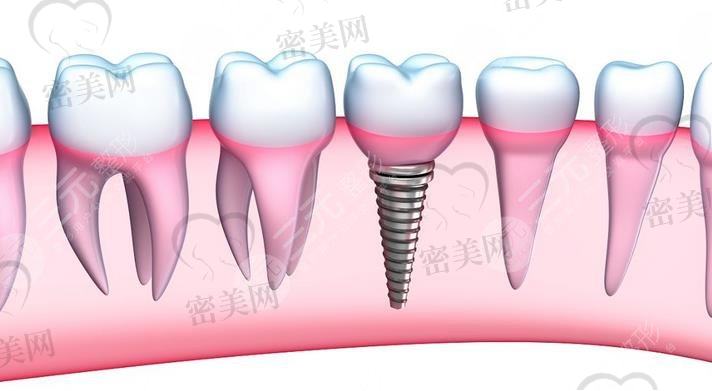 深圳第二人民医院种牙<span style=