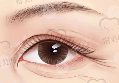 上海薇琳医疗美容医院眼部整形
