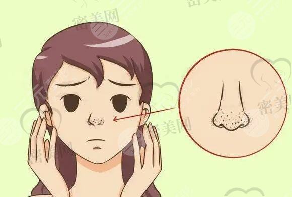 鼻头毛孔粗大是由于哪些方面导致的?