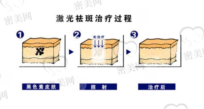 龙华人民医院祛斑皮肤科科室介绍