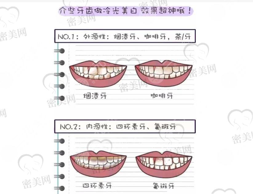 深圳美莱口腔门诊部擅长项目