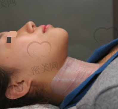 重庆光博士祛颈纹手术当天照片