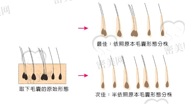 毛囊提取分离