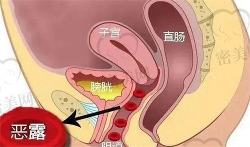 恶露示意图