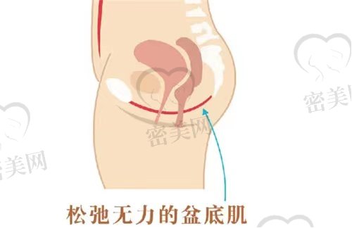 坐月子好好的复健自己的盆底肌要多训练