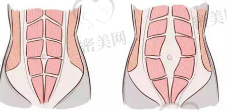 产后恢复需要注意什么