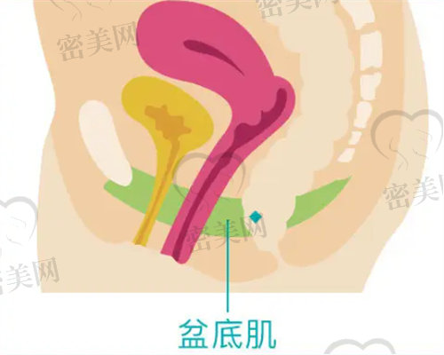 盆底肌松弛怎么办？