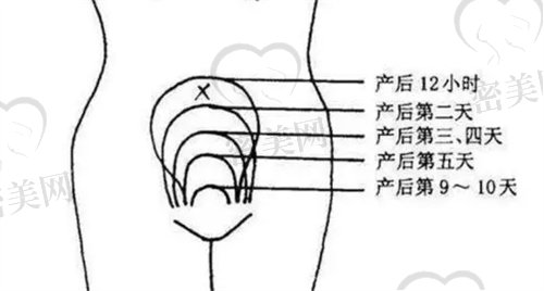 出现宫缩这样子的事情要咋缓解好