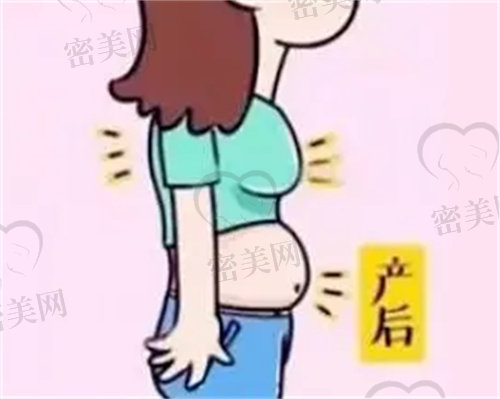 产后肚子大