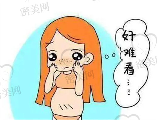 产后大肚子不好看
