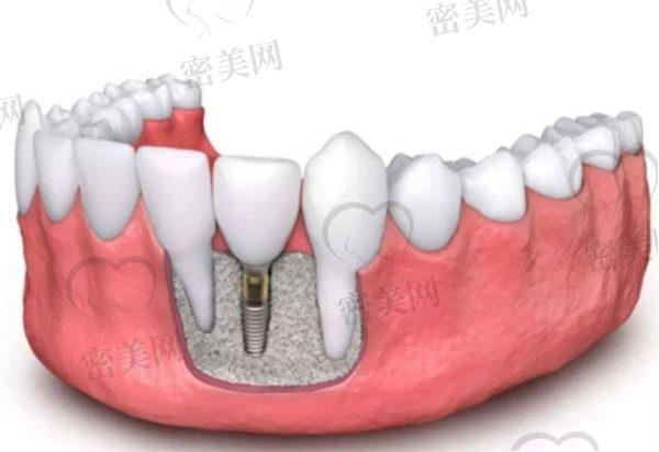 遂昌牙科医院怎么样？遂昌牙科医院收费贵吗本文有价格哦