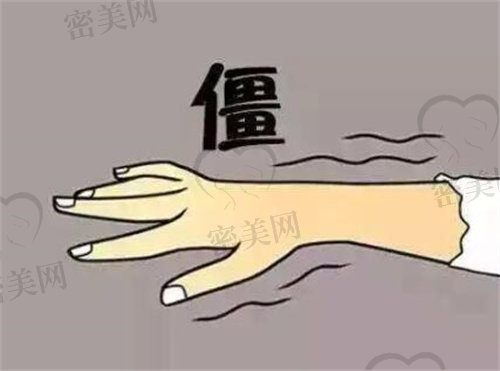 产后手指关节疼痛僵硬