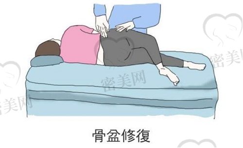 产后骨盆修复