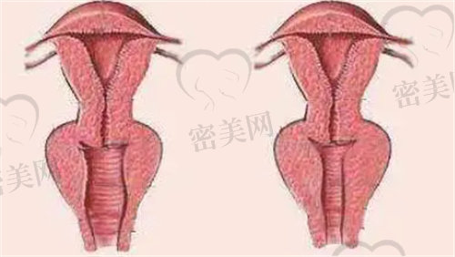 上海虹桥医院私密整形价格表