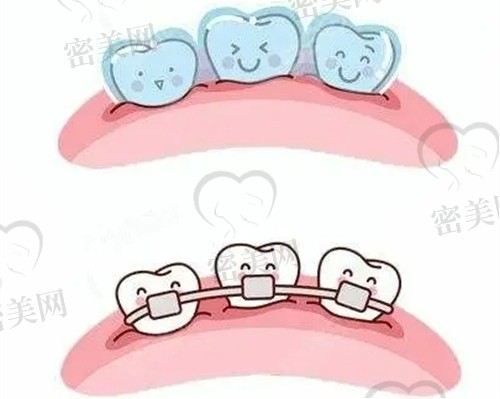 上海鼎植口腔牙齿矫正价格实惠