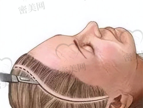 北京穆宝安可以做面部提升手术吗？