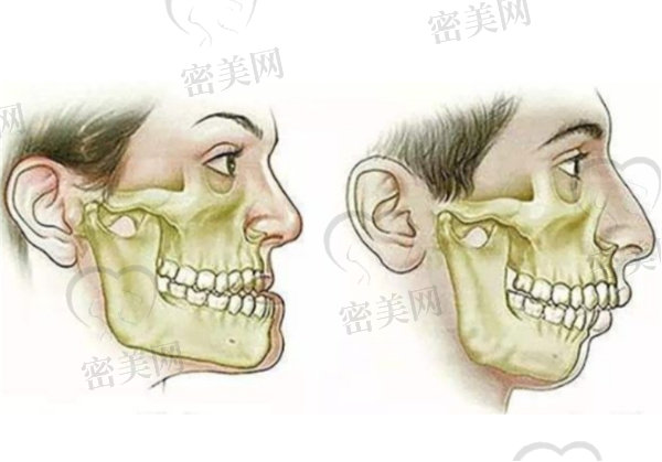 正颌手术风险大吗,过程是怎样的？