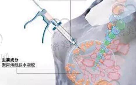 邓正军异物取出口碑好吗