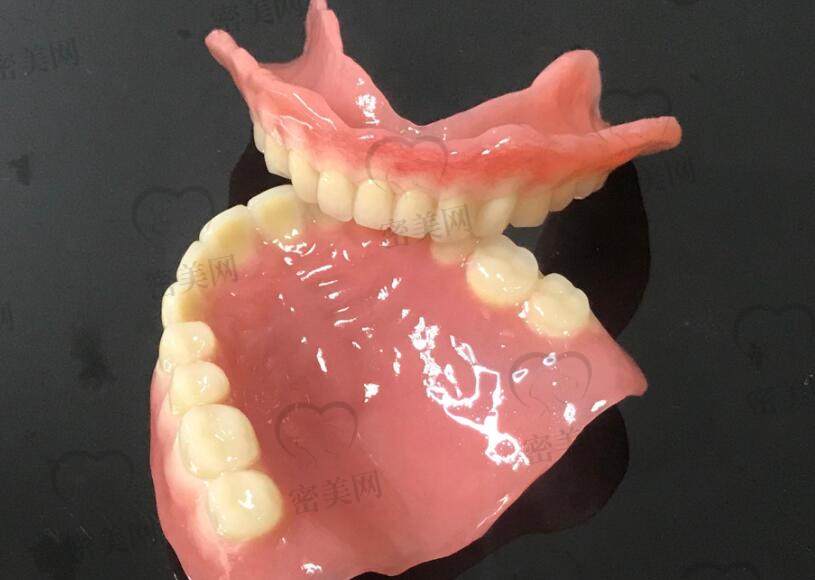 全口吸附性义齿和普通义齿的区别在哪