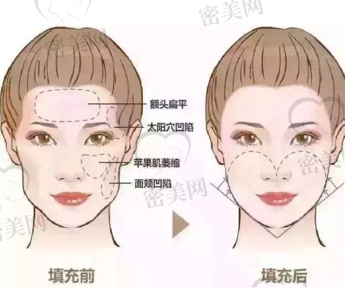 面部内轮廓和外轮廓有什么区别？