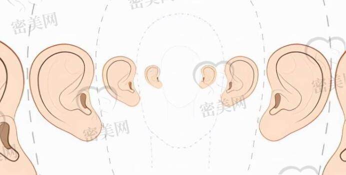 生物材料造耳的缺点、优点是什么