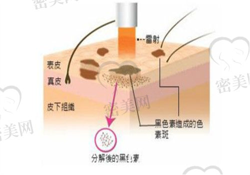 改善肤色和毛孔的方法有3种