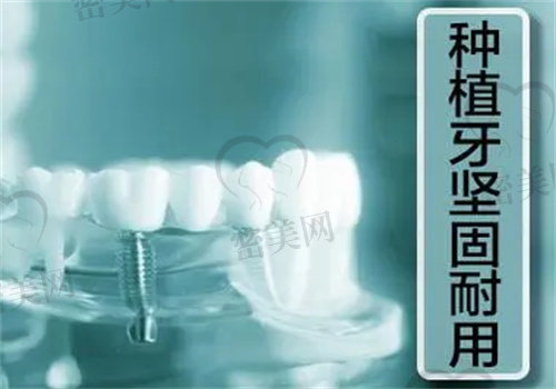 潍坊市人民医院口腔科种植牙价格表