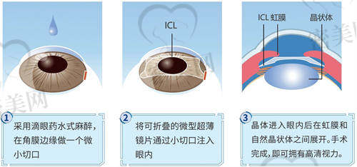 山西省眼科医院地址和交通路线