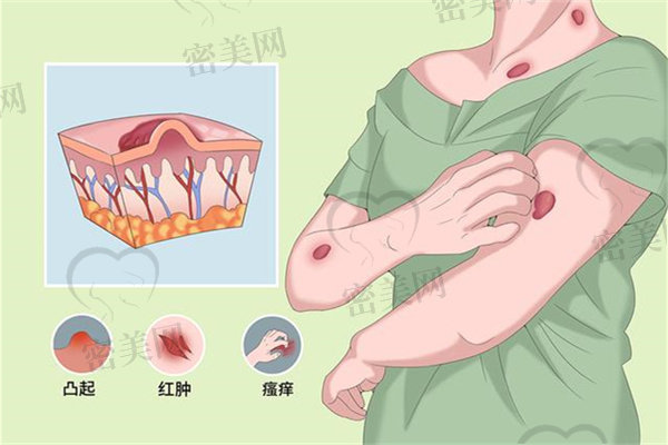 深圳去疤痕哪家医院好