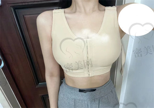 下皱襞隆胸拆完线就不痛了吗多久能好？