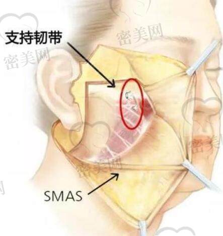 微拉美和筋膜悬吊哪个更好