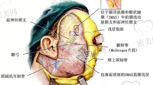 双面网兜提升术和筋膜悬吊术区别在哪