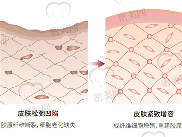 艾唯岚适合打哪里？