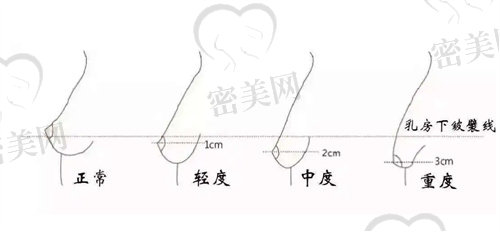维多利亚整形医院价格表 维多利亚整形医院价格表