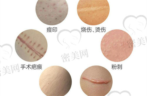 武汉哪里去疤痕比较好