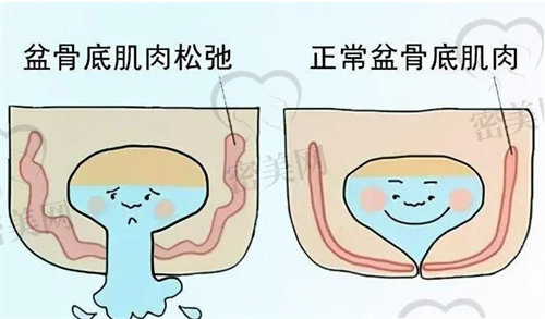 紧缩针长沙哪里可以打