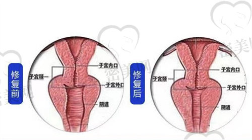 紧缩针长沙哪里可以打 紧缩针长沙哪里可以打