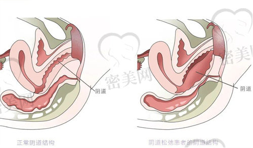 紧缩针长沙哪里可以打