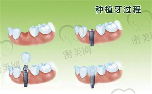 北京劲松口腔医院怎么样