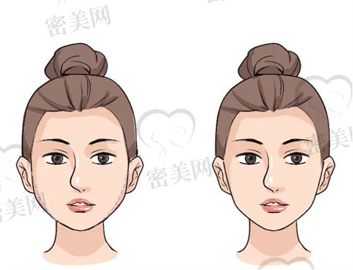上海面部馒化修复哪个医生好