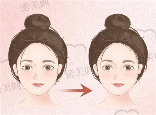 上海面部馒化修复哪个医生好