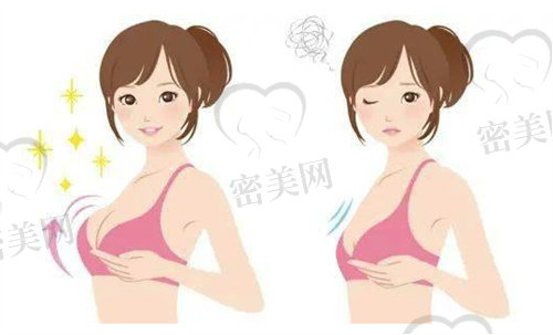 上海隆胸较好的整形医院是哪家
