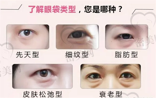 成都健丽医美去眼袋怎么样