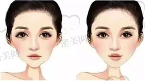北京脂肪填充专门医院排名榜